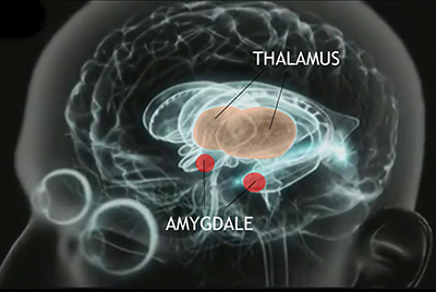 amygdale-cerebrale